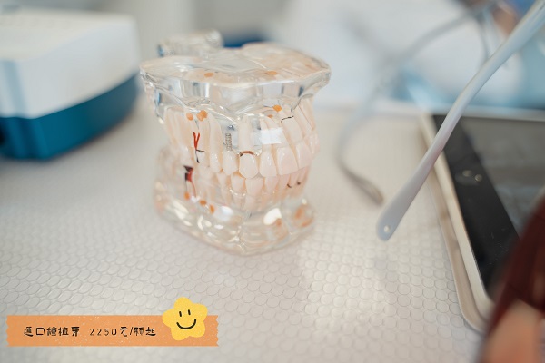 2024合肥口腔醫院種植牙費用一覽，種植后怎么保護牙齒？