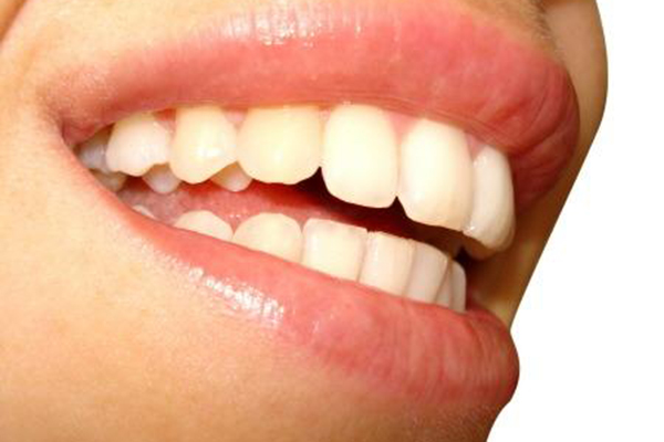 合肥兒童牙齒涂氟好處多多？