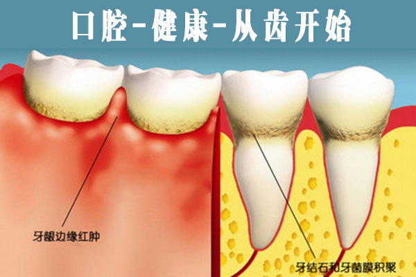 牙齒疾病怎么治療？